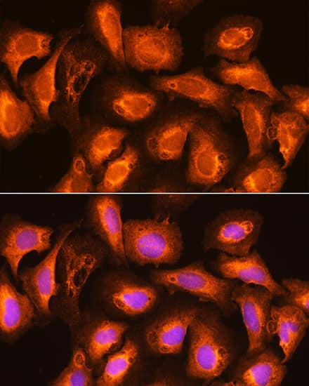 Immunocytochemistry/ Immunofluorescence SPC18 Antibody - Azide and BSA Free