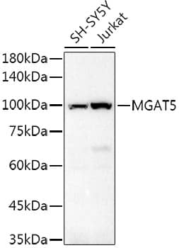 Western Blot: N-Acetylglucosaminyltransferase V/MGAT5 Antibody - Azide and BSA Free [NBP2-94188] - Western blot analysis of extracts of various cell lines, using N-Acetylglucosaminyltransferase V/MGAT5 Rabbit pAb antibody (A10567) at 1:500 dilution.Secondary antibody: HRP Goat Anti-Rabbit IgG (H+L) (AS014) at 1:10000 dilution.Lysates/proteins: 25μg per lane.Blocking buffer: 3% nonfat dry milk in TBST.Detection: ECL Basic Kit (RM00020).Exposure time: 180s.