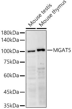 Western Blot: N-Acetylglucosaminyltransferase V/MGAT5 Antibody - Azide and BSA Free [NBP2-94188] - Western blot analysis of extracts of various cell lines, using N-Acetylglucosaminyltransferase V/MGAT5 Rabbit pAb antibody (A10567) at 1:500 dilution.Secondary antibody: HRP Goat Anti-Rabbit IgG (H+L) (AS014) at 1:10000 dilution.Lysates/proteins: 25μg per lane.Blocking buffer: 3% nonfat dry milk in TBST.Detection: ECL Enhanced Kit (RM00021).Exposure time: 90s.