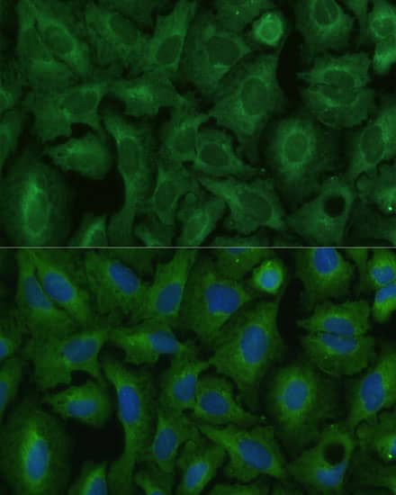 Immunocytochemistry/ Immunofluorescence: TIMM8B Antibody - Azide and BSA Free [TIMM8B] - Immunofluorescence analysis of U-2 OS cells using TIMM8B Rabbit pAb  at dilution of 1:100 (40x lens). Secondary antibody: Cy3 Goat Anti-Rabbit IgG (H+L)  at 1:500 dilution. Blue: DAPI for nuclear staining.