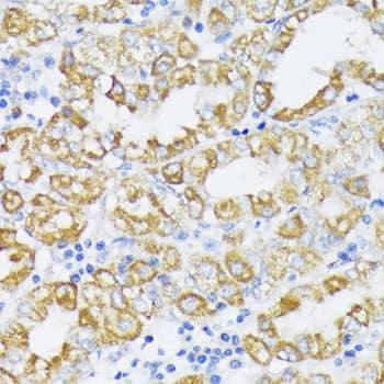 Immunohistochemistry SLC30A1 Antibody - BSA Free