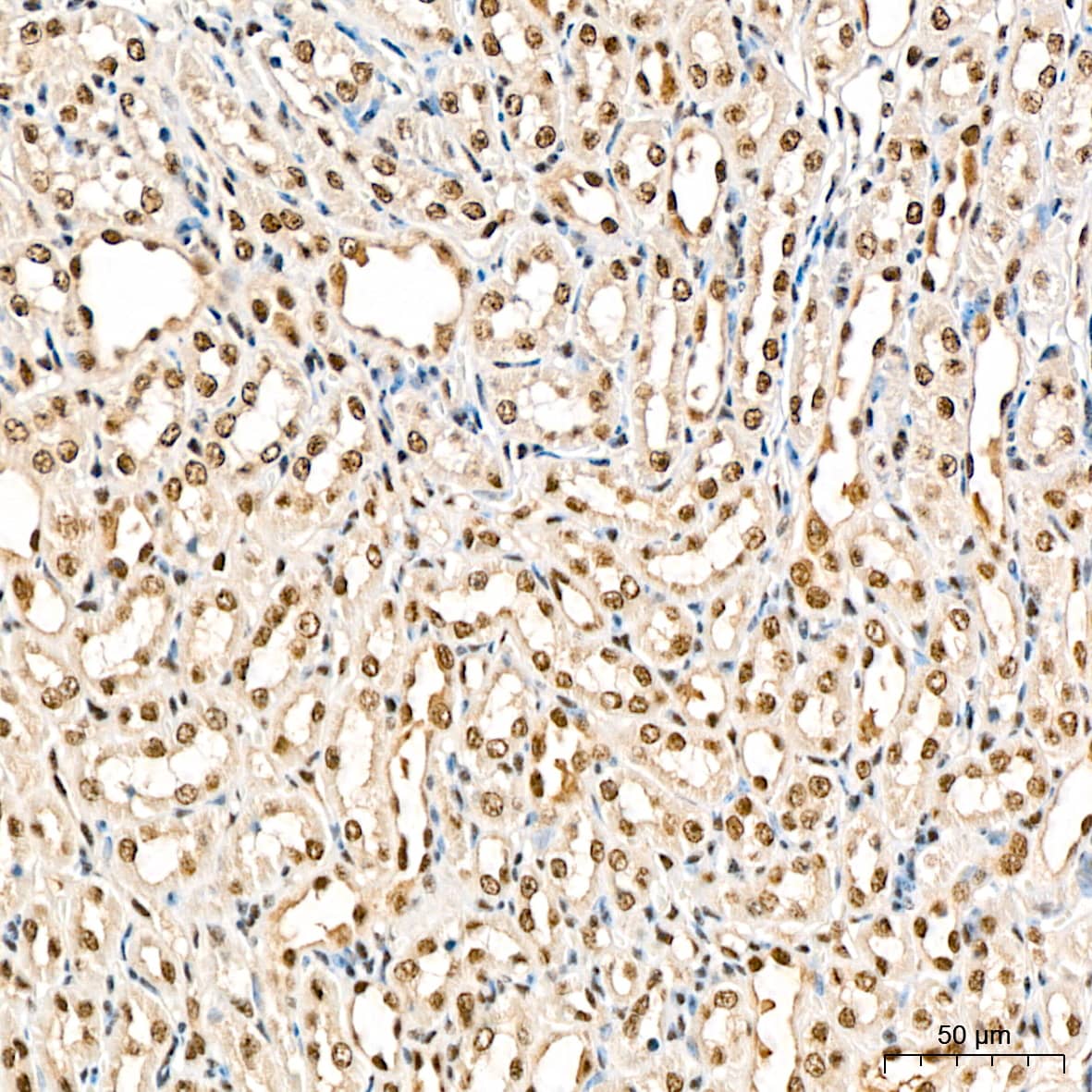 Immunohistochemistry: TRMT61A Antibody - Azide and BSA Free [TRMT61A] - Immunohistochemistry analysis of paraffin-embedded Rat kidney tissue using TRMT61A Rabbit pAb  at a dilution of 1:200 (40x lens). High pressure antigen retrieval performed with 0.01M Citrate Bufferr (pH 6.0) prior to IHC staining.