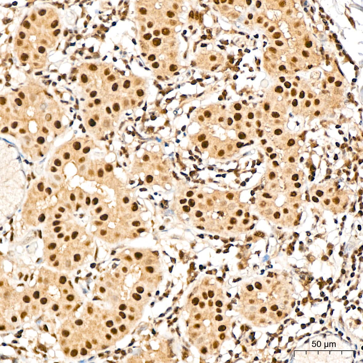 Immunohistochemistry TRMT61A Antibody - Azide and BSA Free