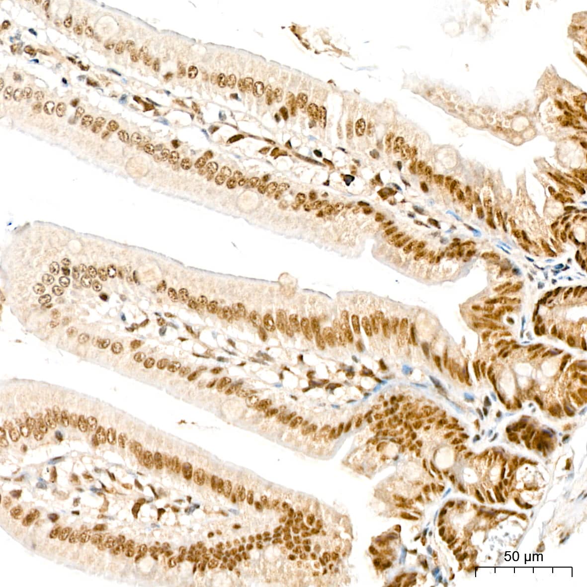 Immunohistochemistry: TRMT61A Antibody - Azide and BSA Free [TRMT61A] - Immunohistochemistry analysis of paraffin-embedded Mouse intestin tissue using TRMT61A Rabbit pAb  at a dilution of 1:200 (40x lens). High pressure antigen retrieval performed with 0.01M Citrate Bufferr (pH 6.0) prior to IHC staining.