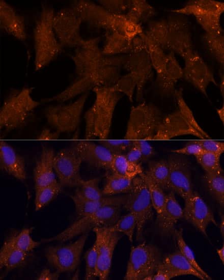 Immunocytochemistry/ Immunofluorescence: PGK2 Antibody - Azide and BSA Free [PGK2] - Immunofluorescence analysis of C6 cells using PGK2 Rabbit pAb  at dilution of 1:100 (40x lens). Secondary antibody: Cy3 Goat Anti-Rabbit IgG (H+L)  at 1:500 dilution. Blue: DAPI for nuclear staining.