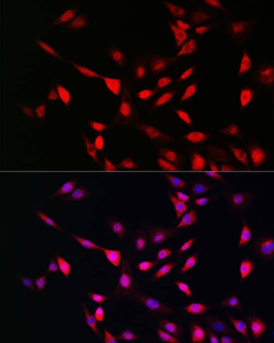 Immunocytochemistry/ Immunofluorescence UFM1 Antibody - Azide and BSA Free