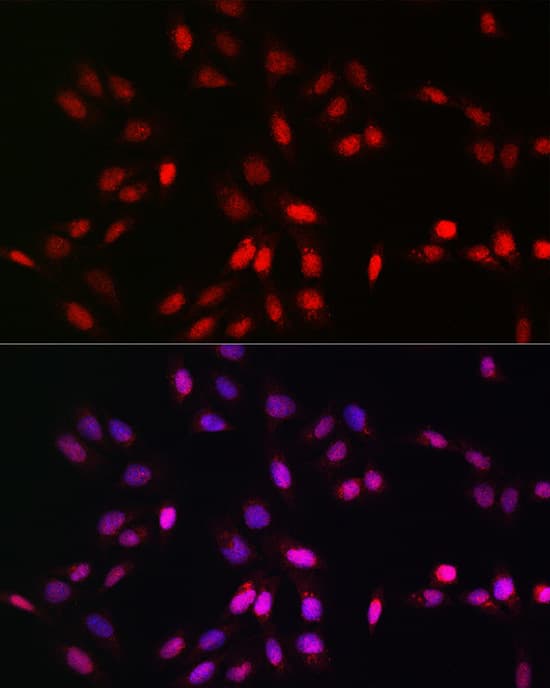 Immunocytochemistry/ Immunofluorescence: UFM1 Antibody - Azide and BSA Free [UFM1] - Immunofluorescence analysis of U2OS cells using UFM1 Rabbit pAb  at dilution of 1:100 (40x lens). Secondary antibody: Cy3-conjugated Goat anti-Rabbit IgG (H+L)  at 1:500 dilution. Blue: DAPI for nuclear staining.