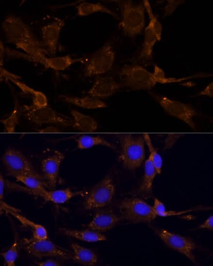 Immunocytochemistry/ Immunofluorescence RPL27 Antibody - Azide and BSA Free