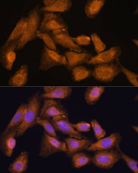 Immunocytochemistry/ Immunofluorescence: RPL27 Antibody - Azide and BSA Free [NBP2-94240] - Immunofluorescence analysis of U-2 OS cells using RPL27 Rabbit pAb (A13044) at dilution of 1:100 (40x lens). Secondary antibody: Cy3 Goat Anti-Rabbit IgG (H+L) (AS007) at 1:500 dilution. Blue: DAPI for nuclear staining.