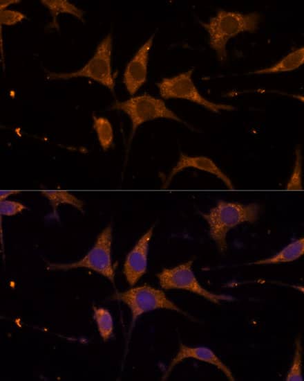 Immunocytochemistry/ Immunofluorescence: RPL27 Antibody - Azide and BSA Free [NBP2-94240] - Immunofluorescence analysis of L929 cells using RPL27 Rabbit pAb (A13044) at dilution of 1:100 (40x lens). Secondary antibody: Cy3 Goat Anti-Rabbit IgG (H+L) (AS007) at 1:500 dilution. Blue: DAPI for nuclear staining.