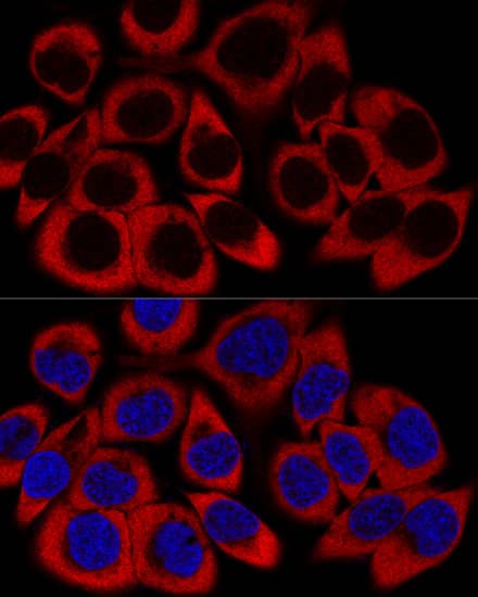 Immunocytochemistry/ Immunofluorescence RPL27 Antibody - Azide and BSA Free