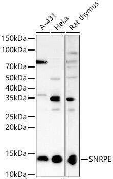 Western Blot: SNRPE Antibody - BSA Free [SNRPE] - Western blot analysis of various lysates, using SNRPE Rabbit pAb  at 1:2000 dilution.Secondary antibody: HRP Goat Anti-Rabbit IgG (H+L)  at 1:10000 dilution.Lysates/proteins: 25ug per lane.Blocking buffer: 3% nonfat dry milk in TBST.Detection: ECL Basic Kit .Exposure time: 180s.