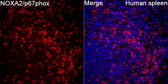 Immunocytochemistry/ Immunofluorescence: p67phox/NOXA2 Antibody - BSA Free [p67phox/NOXA2] - Immunofluorescence analysis of Human spleen tissue using p67phox/NOXA2 Rabbit pAb  at a dilution of 1:100 (40x lens). Secondary antibody: Cy3-conjugated Goat anti-Rabbit IgG (H+L) at 1:500 dilution. Blue: DAPI for nuclear staining. High pressure antigen retrieval performed with 0.01M Citrate Buffer (pH 6.0) prior to IF staining.