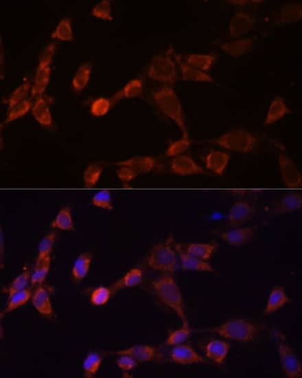 Immunocytochemistry/ Immunofluorescence: PSMD14 Antibody - Azide and BSA Free [NBP2-94276] - Immunofluorescence analysis of NIH-3T3 cells using PSMD14 Rabbit pAb (A10782) at dilution of 1:100 (40x lens). Secondary antibody: Cy3 Goat Anti-Rabbit IgG (H+L) (AS007) at 1:500 dilution. Blue: DAPI for nuclear staining.