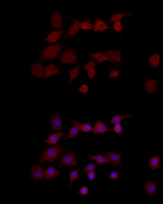 Immunocytochemistry/ Immunofluorescence: NGLY1 Antibody - Azide and BSA Free [NBP2-94289] - Immunofluorescence analysis of PC-12 cells using NGLY1 Rabbit pAb  at dilution of 1:50 (40x lens). Secondary antibody: Cy3-conjugated Goat anti-Rabbit IgG (H+L)  at 1:500 dilution. Blue: DAPI for nuclear staining.