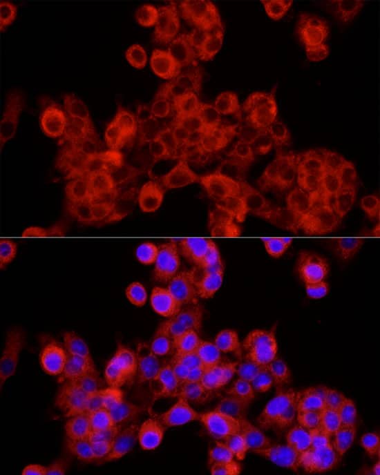 Immunocytochemistry/ Immunofluorescence: SEC24C Antibody - Azide and BSA Free [NBP2-94294] - Immunofluorescence analysis of HepG2 cells using SEC24C Rabbit pAb (A10797) at dilution of 1:100 (40x lens). Secondary antibody: Cy3 Goat Anti-Rabbit IgG (H+L) (AS007) at 1:500 dilution. Blue: DAPI for nuclear staining.