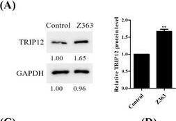 TRIP12 inhibits breast cancer cells proliferation, metastasis and induces apoptosis. (A) MCF7 cells were treated with Z363 (7.5 μg/ml) for 24 h. The protein levels of TRIP12 were analysed by Western blotting. (B) MCF7 cells were transfected with GFP‐TRIP12 or si‐TRIP12 for 24 h, followed by treated with or without Z363 (7.5 μg/ml) for 24 h. The ability of cell to form colonies was measured using crystal violet staining. (C) Statistical analysis of colony formation. (D) MCF7 cells were transfected with GFP‐TRIP12 or si‐TRIP12 for 24 h, followed by treated with or without Z363 (7.5 μg/ml) for 24 h. Cell proliferation of groups were measured by a Ki67 ELISA kit. (E) The expressions of Ki67 and PCNA were analysed by Western blotting. (F) MCF7 cells were transfected with GFP‐TRIP12 or si‐TRIP12 for 24 h, followed by treated with or without Z363 (7.5 μg/ml) for 24 h. MCF7 cells were treated with different groups, followed by assessment of apoptosis by flow cytometry analysis. (G) Statistical analysis of cell apoptosis. (H) Caspase‐3 activity was measured in MCF7 cells treated with different groups. (I) The expressions of Cyto C and p53 were analysed by Western blotting. (J) Cells were transfected with GFP‐TRIP12 or si‐TRIP12 for 24 h, followed by treated with or without Z363 (7.5 μg/ml) for 24 h. Cell migration ability of groups were measured by transwell assays. Scale bar, 20 μm. (K) Statistical analysis of migration ability. Data shown in C, D and G, H, K were analysed by one‐way ANOVA. Colony images, fluorescence images, transwell and blots were representative of three independent experiments. All data are presented as the mean +/- SEM of n = 3. ***p < .001, **p < .01, ns, no significance Image collected and cropped by CiteAb from the following open publication (//pubmed.ncbi.nlm.nih.gov/36639831), licensed under a CC-BY license. Not internally tested by Novus Biologicals.