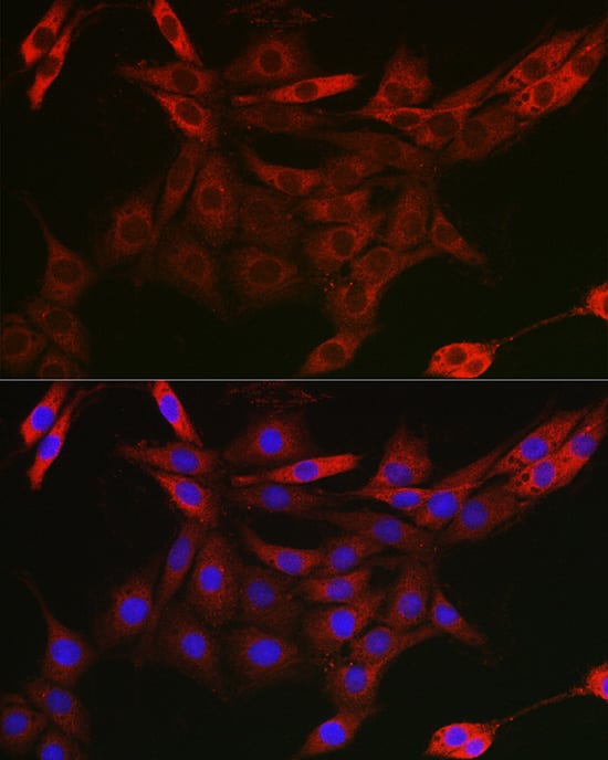 Immunocytochemistry/ Immunofluorescence: UBQLN4/CIP75 Antibody - Azide and BSA Free [UBQLN4/CIP75] - Immunofluorescence analysis of PC-12 cells using UBQLN4/CIP75 Rabbit pAb  at dilution of 1:50 (40x lens). Secondary antibody: Cy3 Goat Anti-Rabbit IgG (H+L)  at 1:500 dilution. Blue: DAPI for nuclear staining.