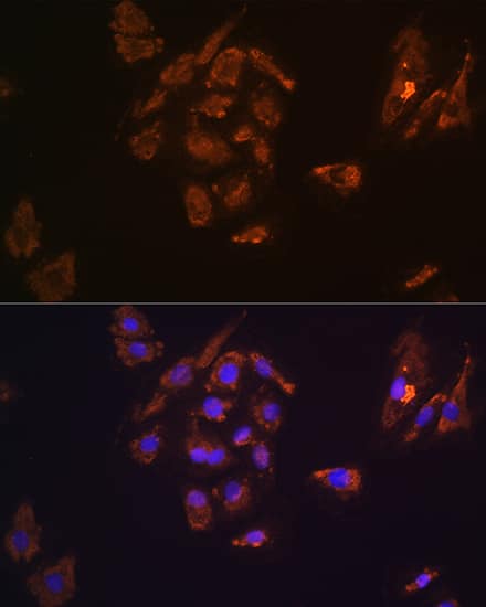 Immunocytochemistry/ Immunofluorescence: Thyrotropin Releasing Hormone Antibody - Azide and BSA Free [NBP2-94348] - Immunofluorescence analysis of H9C2 cells using Thyrotropin Releasing Hormone Rabbit pAb (A14472) at dilution of 1:100. Secondary antibody: Cy3 Goat Anti-Rabbit IgG (H+L) (AS007) at 1:500 dilution. Blue: DAPI for nuclear staining.