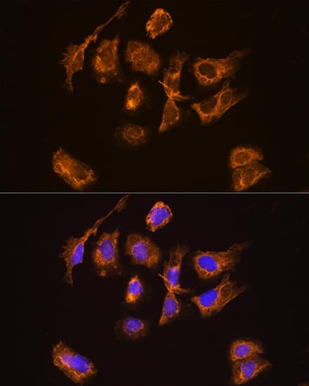 Immunocytochemistry/ Immunofluorescence: Thyrotropin Releasing Hormone Antibody - Azide and BSA Free [NBP2-94348] - Immunofluorescence analysis of U2OS cells using Thyrotropin Releasing Hormone Rabbit pAb (A14472) at dilution of 1:100. Secondary antibody: Cy3 Goat Anti-Rabbit IgG (H+L) (AS007) at 1:500 dilution. Blue: DAPI for nuclear staining.