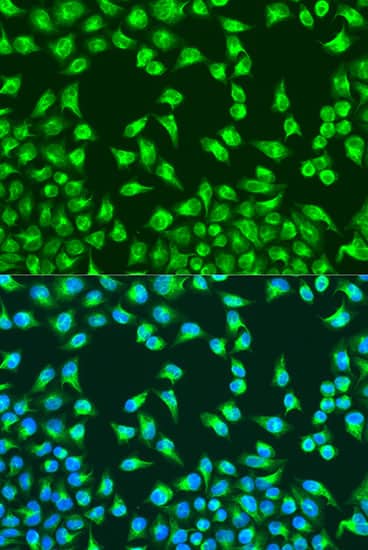 Immunocytochemistry/ Immunofluorescence: MT-CO2 Antibody - BSA Free [MT-CO2] - Immunofluorescence analysis of U2OS cells using MT-CO2 Rabbit pAb  at dilution of 1:100. Secondary antibody: Cy3-conjugated Goat anti-Rabbit IgG (H+L)  at 1:500 dilution. Blue: DAPI for nuclear staining.