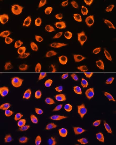 Immunocytochemistry/ Immunofluorescence: protocadherin beta 4 Antibody - Azide and BSA Free [NBP2-94386] - Immunofluorescence analysis of L929 cells using protocadherin beta 4 Rabbit pAb (A17733) at dilution of 1:100. Secondary antibody: Cy3 Goat Anti-Rabbit IgG (H+L) (AS007) at 1:500 dilution. Blue: DAPI for nuclear staining.