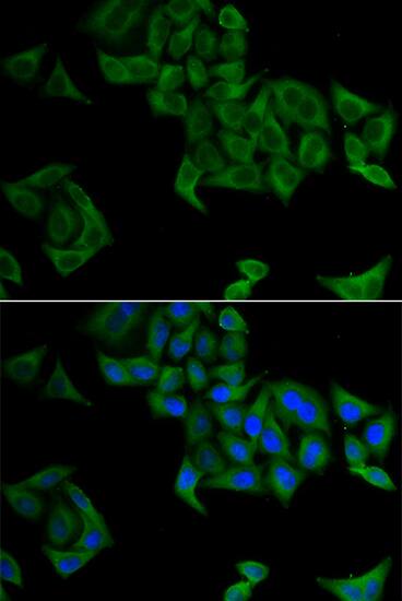 Immunocytochemistry/ Immunofluorescence: SMYD5 Antibody - BSA Free [SMYD5] - Immunofluorescence analysis of A549 cells using SMYD5 Rabbit pAb . Secondary antibody: Cy3 Goat Anti-Rabbit IgG (H+L)  at 1:500 dilution. Blue: DAPI for nuclear staining.