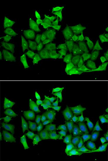 Immunocytochemistry/ Immunofluorescence RhoH Antibody - BSA Free