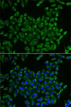 Immunocytochemistry/ Immunofluorescence: MRPS30 Antibody - BSA Free [NBP2-94408] - Immunofluorescence analysis of U2OS cells using MRPS30 Rabbit pAb (A5841). Secondary antibody: Cy3 Goat Anti-Rabbit IgG (H+L) (AS007) at 1:500 dilution. Blue: DAPI for nuclear staining.