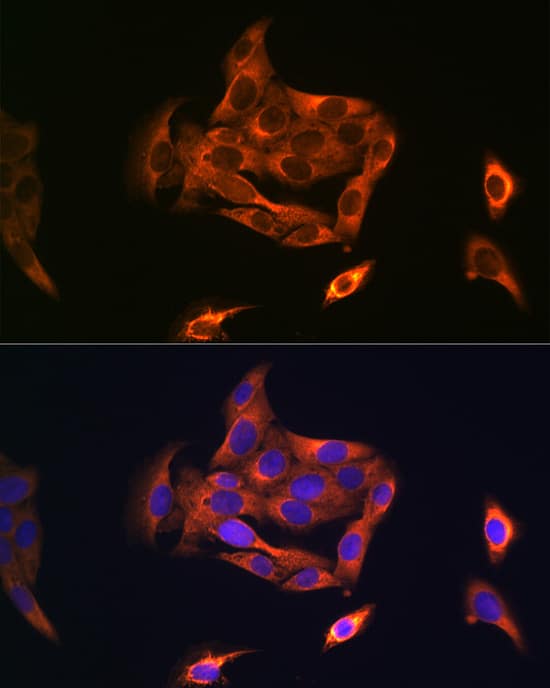 Immunocytochemistry/ Immunofluorescence: NOSTRIN Antibody - Azide and BSA Free [NBP2-94431] - Immunofluorescence analysis of U-2 OS cells using NOSTRIN Rabbit pAb (A15938) at dilution of 1:100 (40x lens). Secondary antibody: Cy3 Goat Anti-Rabbit IgG (H+L) (AS007) at 1:500 dilution. Blue: DAPI for nuclear staining.