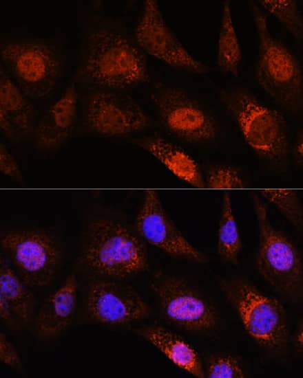 Immunocytochemistry/ Immunofluorescence ZC3H12D Antibody - Azide and BSA Free