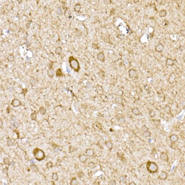 Immunohistochemistry: MTCO1 Antibody - Azide and BSA Free [NBP2-94458] - Immunohistochemistry analysis of paraffin-embedded rat brain using MTCO1 Rabbit pAb (A17889) at dilution of 1:100 (40x lens).Perform high pressure antigen retrieval with 10 mM citrate buffer pH 6.0 before commencing with IHC staining protocol.