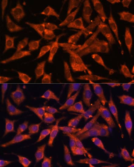 Immunocytochemistry/ Immunofluorescence: MT-ND1 Antibody - Azide and BSA Free [MT-ND1] - Immunofluorescence analysis of L929 cells using MT-ND1 Rabbit pAb  at dilution of 1:100 (40x lens). Secondary antibody: Cy3 Goat Anti-Rabbit IgG (H+L)  at 1:500 dilution. Blue: DAPI for nuclear staining.