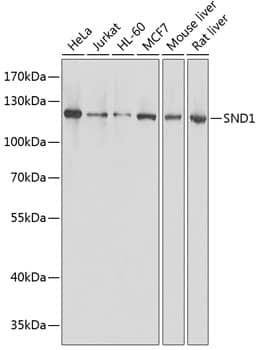 Western Blot: SND1 Antibody - Azide and BSA Free [SND1] - Western blot analysis of various lysates using [KO Validated] SND1 Rabbit pAb  at 1:1000 dilution.Secondary antibody: HRP-conjugated Goat anti-Rabbit IgG (H+L)  at 1:10000 dilution.Lysates/proteins: 25ug per lane.Blocking buffer: 3% nonfat dry milk in TBST.Detection: ECL Basic Kit .Exposure time: 1s.