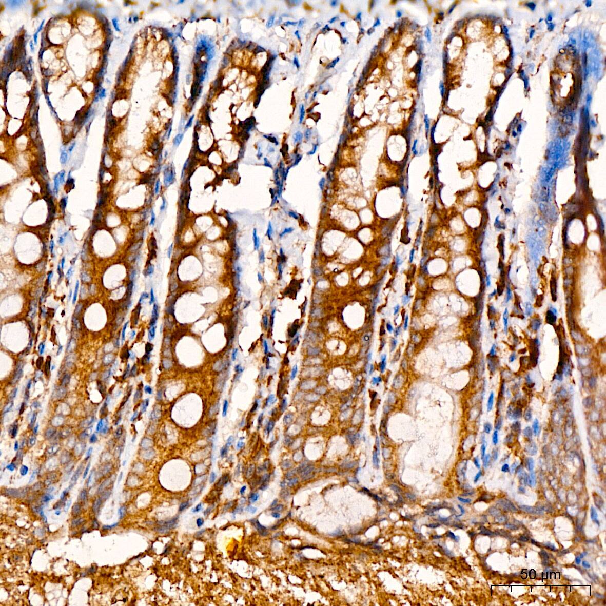 Immunohistochemistry: SND1 Antibody - Azide and BSA Free [SND1] - Immunohistochemistry analysis of paraffin-embedded Rat colon using [KO Validated] SND1 Rabbit pAb  at dilution of 1:200 (40x lens). High pressure antigen retrieval performed with 0.01M Citrate Bufferr (pH 6.0) prior to IHC staining.