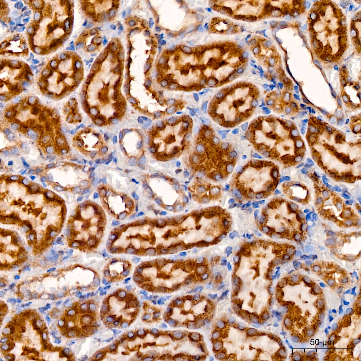 Immunohistochemistry: SND1 Antibody - Azide and BSA Free [SND1] - Immunohistochemistry analysis of paraffin-embedded Rat kidney using [KO Validated] SND1 Rabbit pAb  at dilution of 1:200 (40x lens). High pressure antigen retrieval performed with 0.01M Citrate Bufferr (pH 6.0) prior to IHC staining.