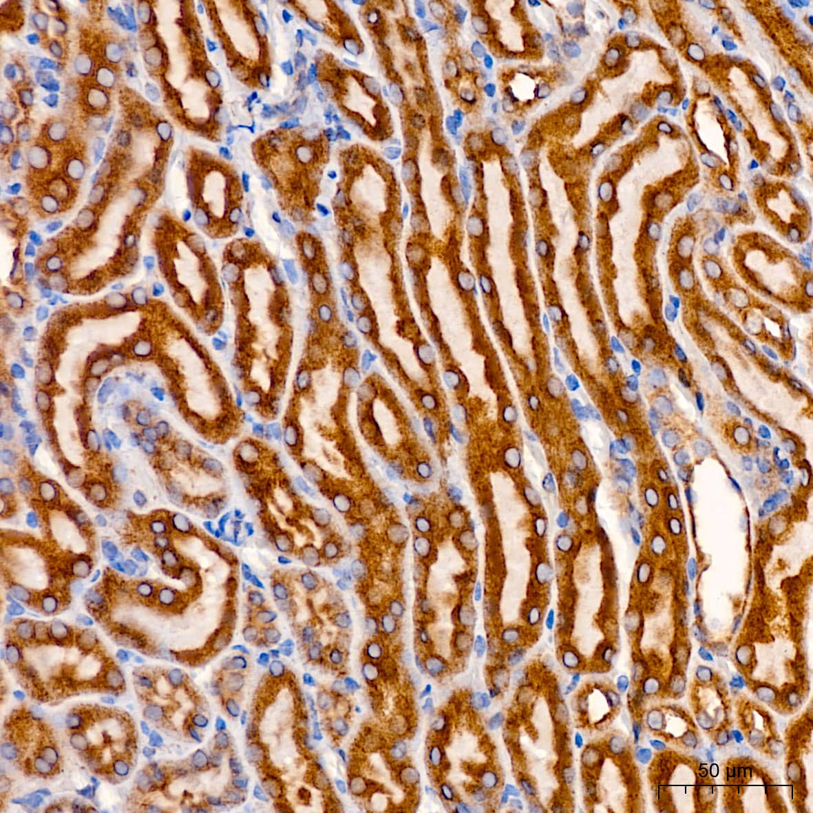 Immunohistochemistry: SND1 Antibody - Azide and BSA Free [SND1] - Immunohistochemistry analysis of paraffin-embedded Mouse kidney using [KO Validated] SND1 Rabbit pAb  at dilution of 1:200 (40x lens). High pressure antigen retrieval performed with 0.01M Citrate Bufferr (pH 6.0) prior to IHC staining.