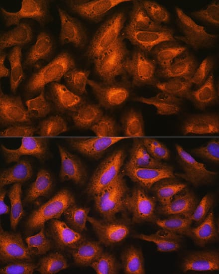 Immunocytochemistry/ Immunofluorescence: eIF2B4 Antibody - Azide and BSA Free [NBP2-94484] - Immunofluorescence analysis of U2OS cells using eIF2B4 Rabbit pAb (A18203) at dilution of 1:100. Secondary antibody: Cy3 Goat Anti-Rabbit IgG (H+L) (AS007) at 1:500 dilution. Blue: DAPI for nuclear staining.