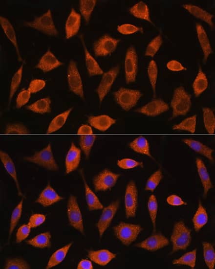 Immunocytochemistry/ Immunofluorescence: eIF2B4 Antibody - Azide and BSA Free [NBP2-94484] - Immunofluorescence analysis of L929 cells using eIF2B4 Rabbit pAb (A18203) at dilution of 1:100. Secondary antibody: Cy3 Goat Anti-Rabbit IgG (H+L) (AS007) at 1:500 dilution. Blue: DAPI for nuclear staining.