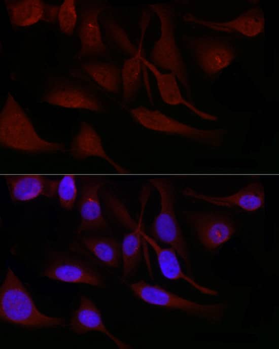 Immunocytochemistry/ Immunofluorescence: SNRPD1 Antibody - Azide and BSA Free [SNRPD1] - Immunofluorescence analysis of U2OS cells using SNRPD1 Rabbit pAb  at dilution of 1:50 (40x lens). Secondary antibody: Cy3 Goat Anti-Rabbit IgG (H+L)  at 1:500 dilution. Blue: DAPI for nuclear staining.
