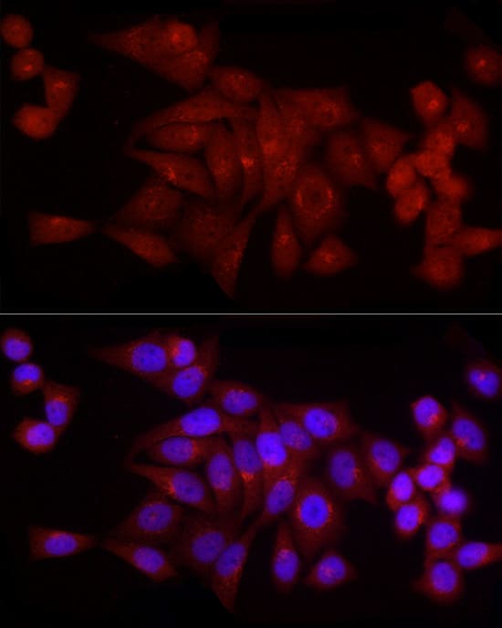 Immunocytochemistry/ Immunofluorescence: SNRPD1 Antibody - Azide and BSA Free [SNRPD1] - Immunofluorescence analysis of HeLa cells using SNRPD1 Rabbit pAb  at dilution of 1:50 (40x lens). Secondary antibody: Cy3 Goat Anti-Rabbit IgG (H+L)  at 1:500 dilution. Blue: DAPI for nuclear staining.