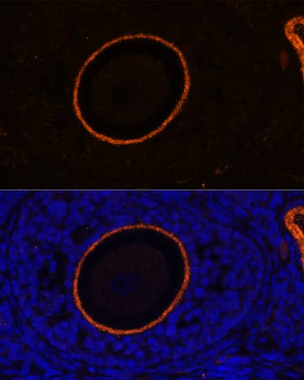 Immunocytochemistry/ Immunofluorescence: ZP3 Antibody - Azide and BSA Free [NBP2-94499] - Immunofluorescence analysis of paraffin-embedded rat oophoroma using ZP3 Rabbit pAb (A13156) at dilution of 1:100. Secondary antibody: Cy3 Goat Anti-Rabbit IgG (H+L) (AS007) at 1:500 dilution. Blue: DAPI for nuclear staining.