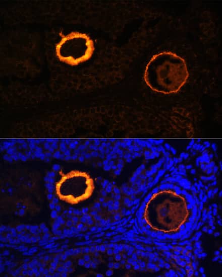 Immunocytochemistry/ Immunofluorescence: ZP3 Antibody - Azide and BSA Free [NBP2-94499] - Immunofluorescence analysis of paraffin-embedded mouse oophoroma using ZP3 Rabbit pAb (A13156) at dilution of 1:100. Secondary antibody: Cy3 Goat Anti-Rabbit IgG (H+L) (AS007) at 1:500 dilution. Blue: DAPI for nuclear staining.