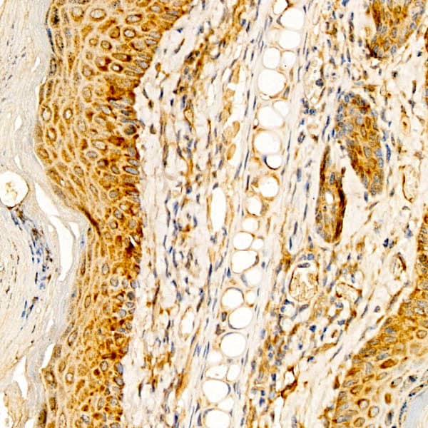 Immunohistochemistry: RPS10 Antibody - BSA Free [NBP2-94502] - Immunohistochemistry analysis of RPS10 in paraffin-embedded human skin tissue using RPS10 Rabbit pAb (A5880) at a dilution of 1:200 (40x lens).High pressure antigen retrieval was performed with 0.01 M citrate buffer (pH 6.0) prior to IHC staining.