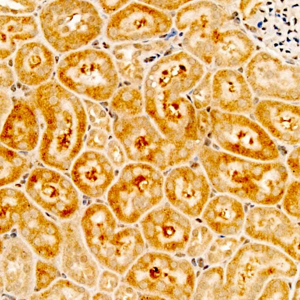 Immunohistochemistry: RPS10 Antibody - BSA Free [NBP2-94502] - Immunohistochemistry analysis of RPS10 in paraffin-embedded mouse kidney tissue using RPS10 Rabbit pAb (A5880) at a dilution of 1:200 (40x lens).High pressure antigen retrieval was performed with 0.01 M citrate buffer (pH 6.0) prior to IHC staining.