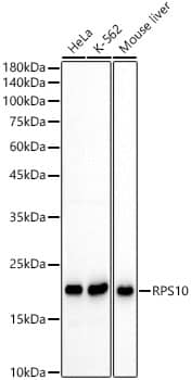 Western Blot: RPS10 Antibody - BSA Free [NBP2-94502] - Western blot analysis of various lysates using RPS10 Rabbit pAb (A5880) at 1:2000 dilution. Secondary antibody:HRP Goat Anti-Rabbit IgG (H+L)(AS014) at 1:10000 dilution. Lysates / proteins: 25 μg per lane. Blocking buffer: 3 % nonfat dry milk in TBST. Detection:ECL Basic Kit (RM00020). Exposuretime: 30s.