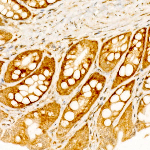 Immunohistochemistry RPS10 Antibody - BSA Free