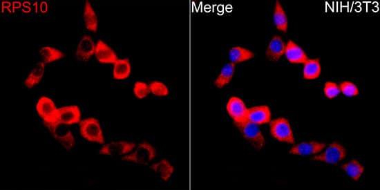 Immunocytochemistry/ Immunofluorescence: RPS10 Antibody - BSA Free [NBP2-94502] - Immunofluorescence analysis of NIH/3T3 cells using RPS10 Rabbit pAb(A5880) at a dilution of 1:500 (40x lens). Secondary antibody:Cy3 Goat Anti-Rabbit IgG (H+L)(AS007) at 1:500 dilution. Blue: DAPI for nuclear staining.