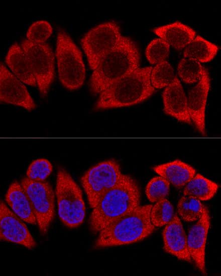 Immunocytochemistry/ Immunofluorescence RPS12 Antibody - BSA Free