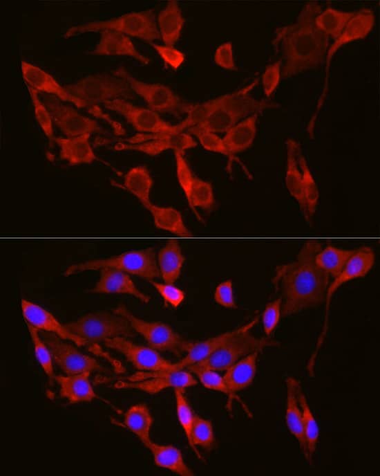 Immunocytochemistry/ Immunofluorescence SEC61A Antibody - Azide and BSA Free